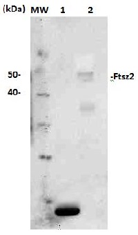 FtsZ2 | Plant cell division protein ftsZ2 in the group Antibodies Plant/Algal / Plant Developmental Biology / Cytoskeleton at Agrisera AB (Antibodies for research) (AS13 2651)